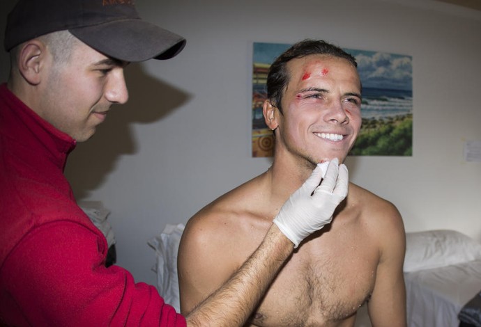 Julian Wilson com o rosto machucado, após se machucar nas rochas de J-Bay antes da bateria contra Medina e Fiilipinho (Foto:  WSL / Pierre Tostee)