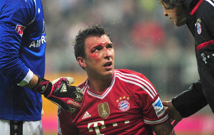 Mandzukic supercílio aberto, Bayern de Munique x Hamburgo (Foto: Getty Images)